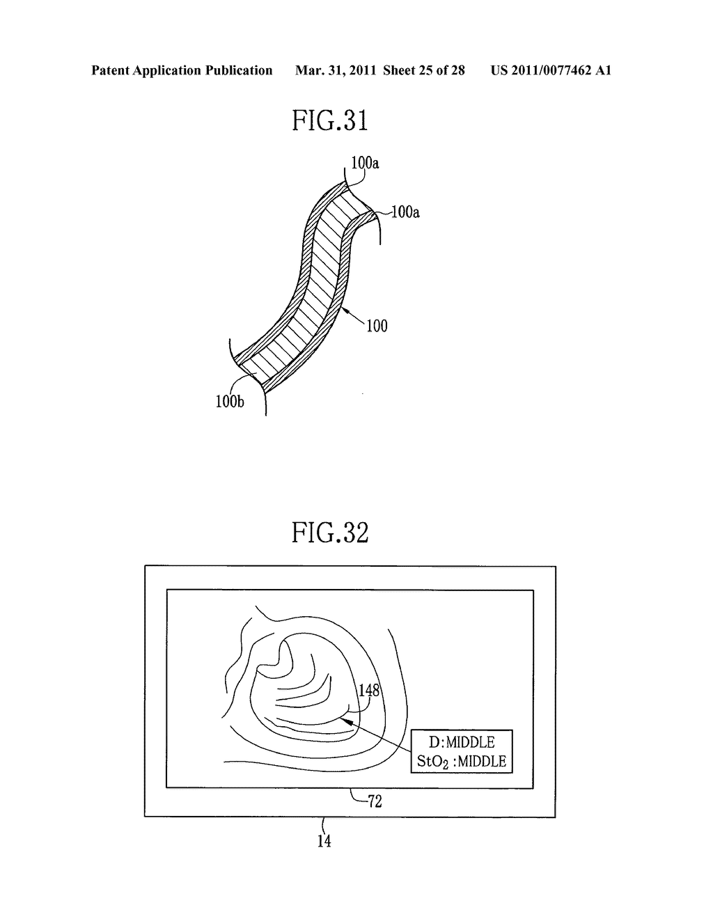 Electronic endoscope system, processor for electronic endoscope, and method of displaying vascular information - diagram, schematic, and image 26