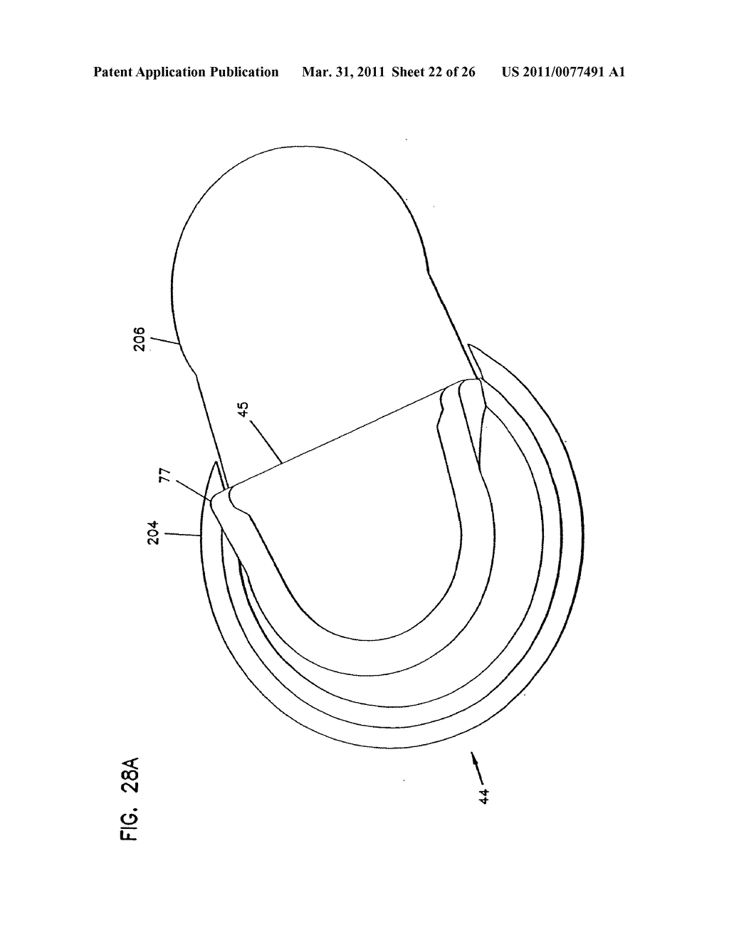 Analyte Monitoring Device and Methods of Use - diagram, schematic, and image 23