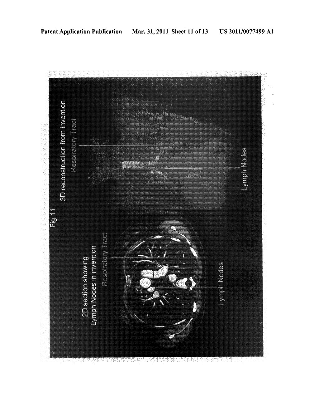 Methods and apparatus for improved diagnoses and oncological treatment and treatment planning - diagram, schematic, and image 12