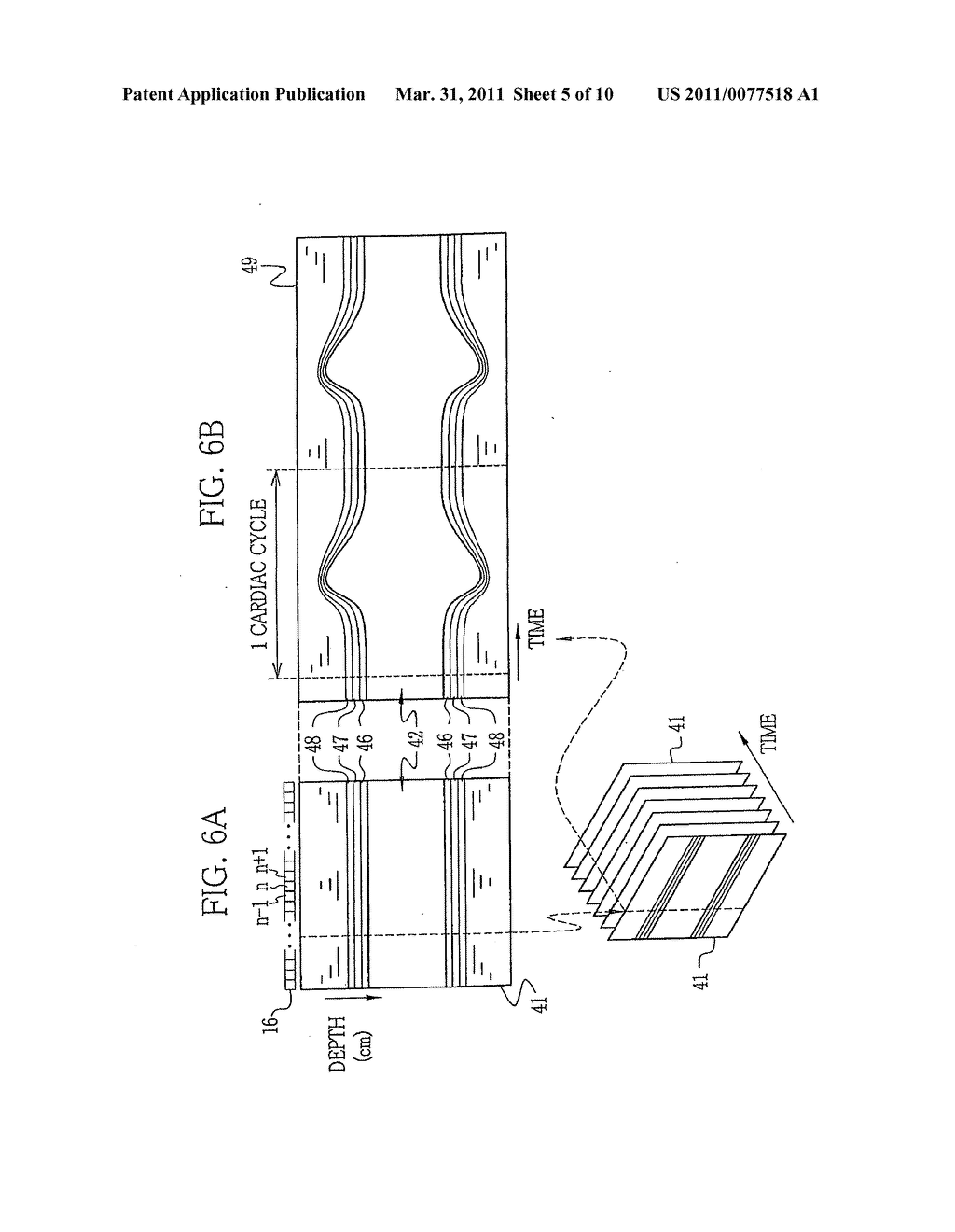 Ultrasonic diagnostic apparatus and method for calculating elasticity index - diagram, schematic, and image 06