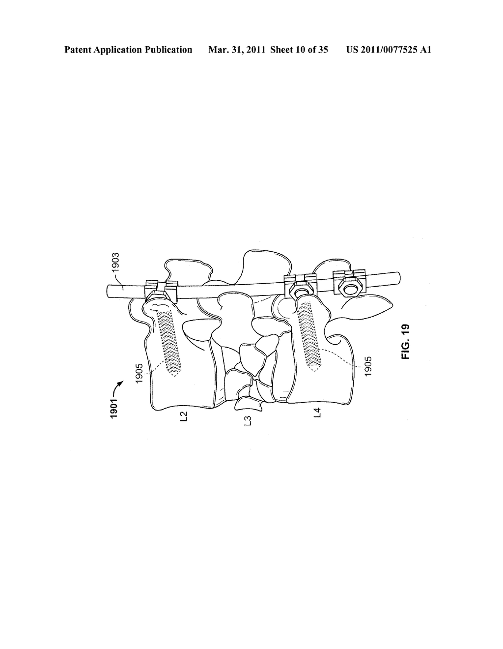 Ultrasound Systems and Methods For Orthopedic Applications - diagram, schematic, and image 11