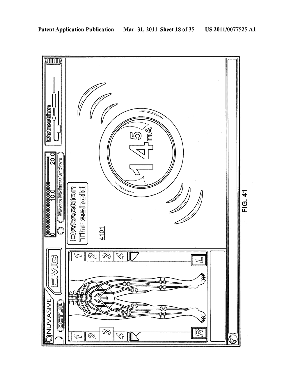 Ultrasound Systems and Methods For Orthopedic Applications - diagram, schematic, and image 19