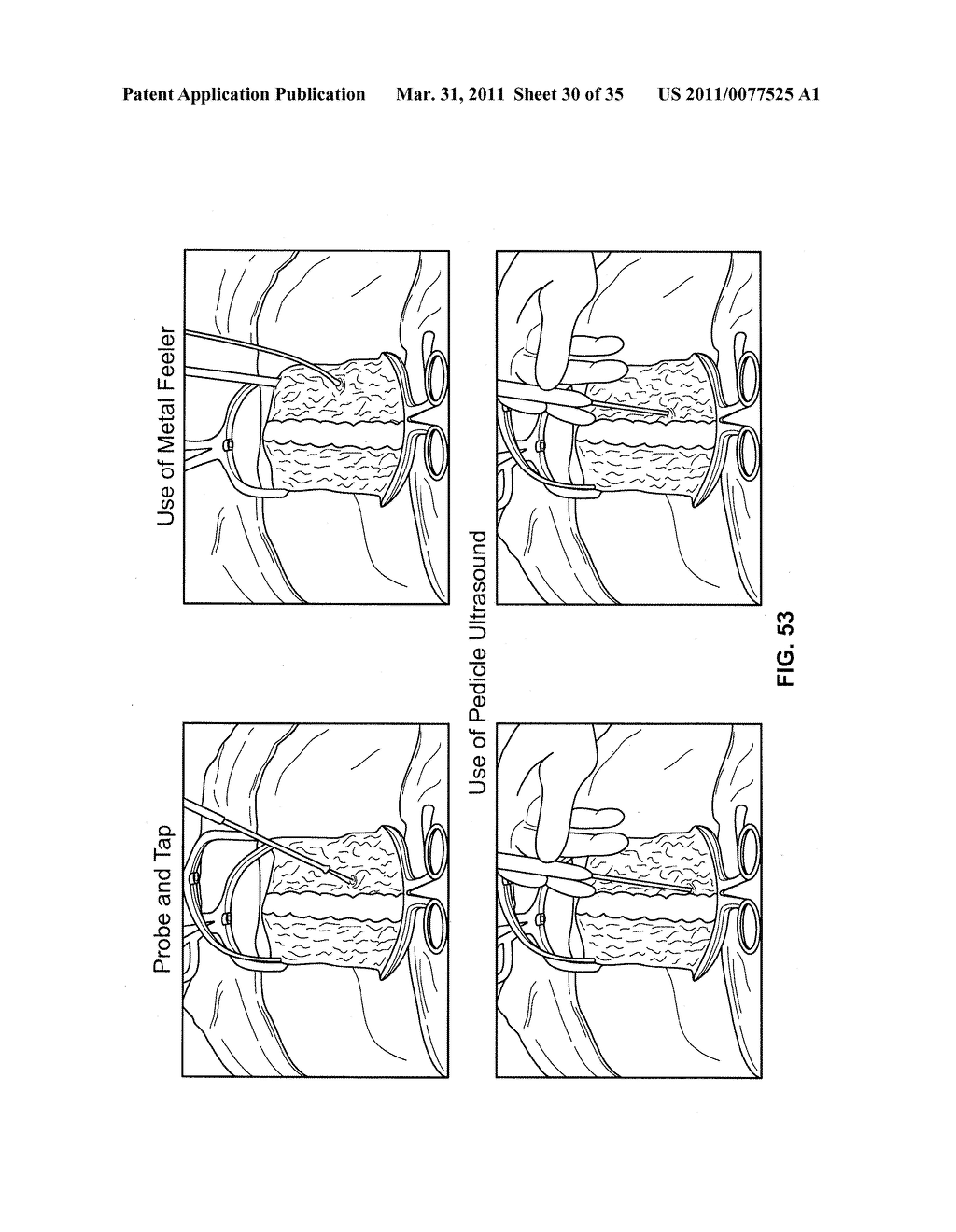 Ultrasound Systems and Methods For Orthopedic Applications - diagram, schematic, and image 31