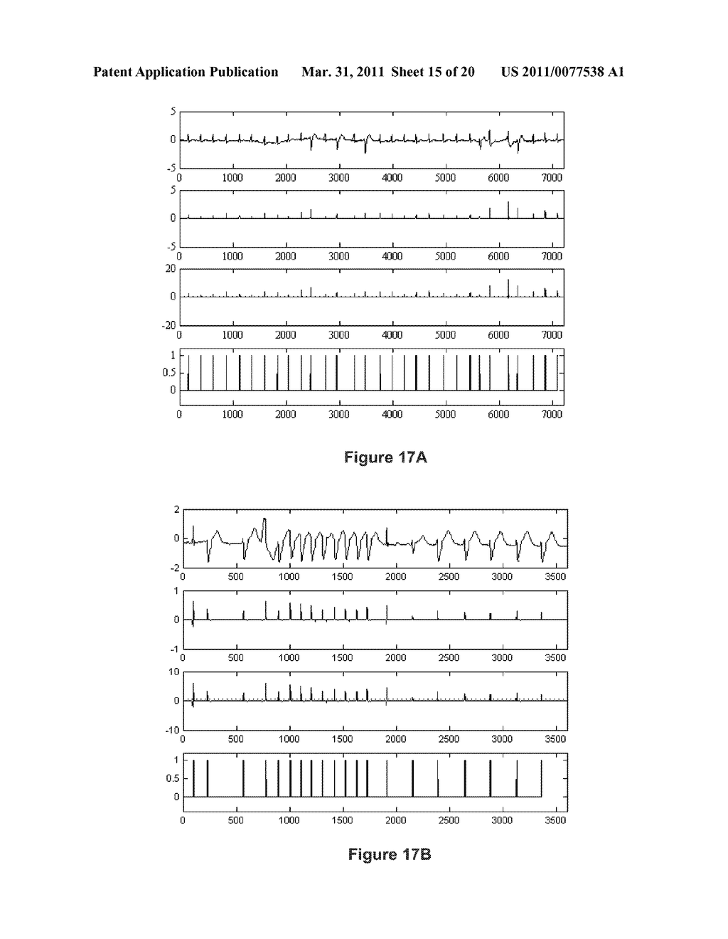 ELECTROCARDIOGRAM SIGNAL PROCESSING SYSTEM - diagram, schematic, and image 16