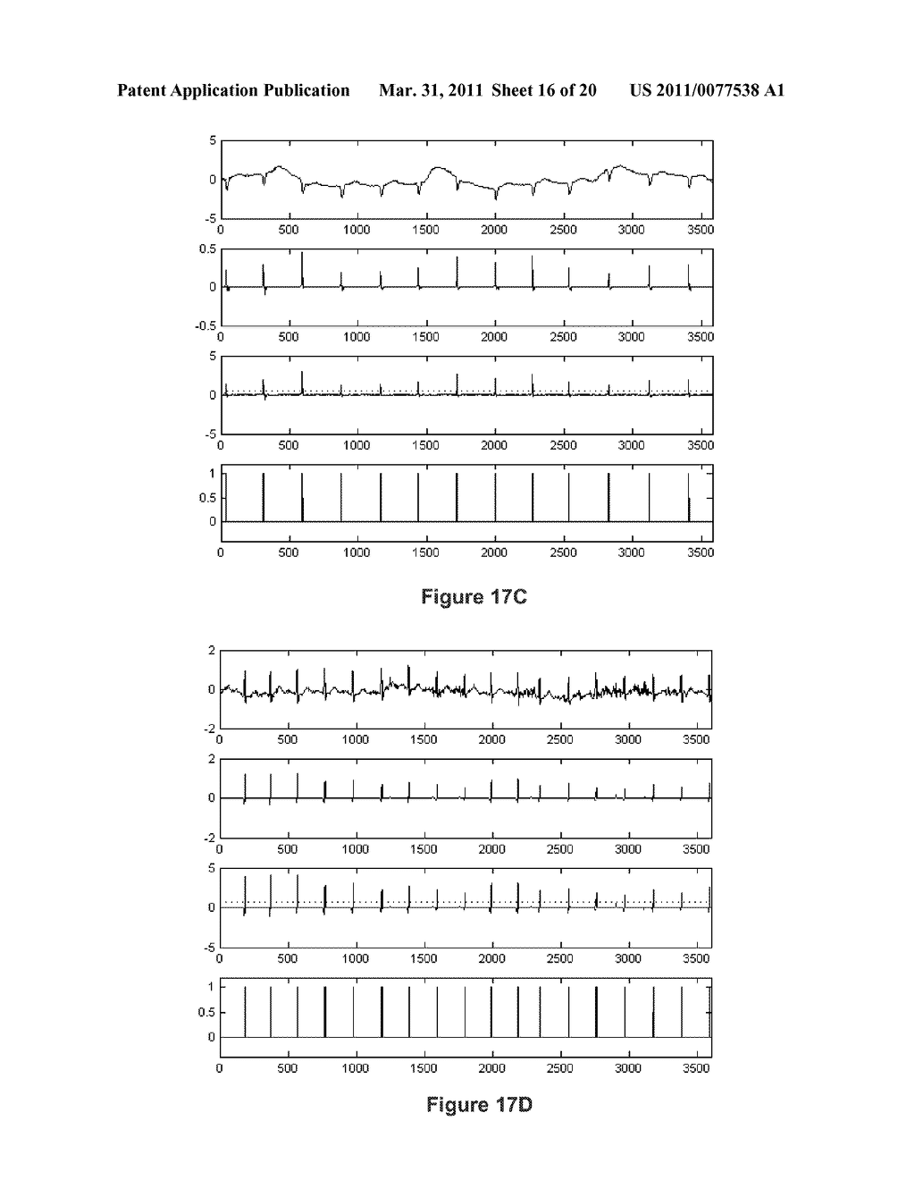 ELECTROCARDIOGRAM SIGNAL PROCESSING SYSTEM - diagram, schematic, and image 17