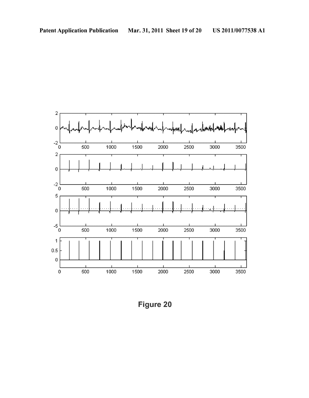 ELECTROCARDIOGRAM SIGNAL PROCESSING SYSTEM - diagram, schematic, and image 20