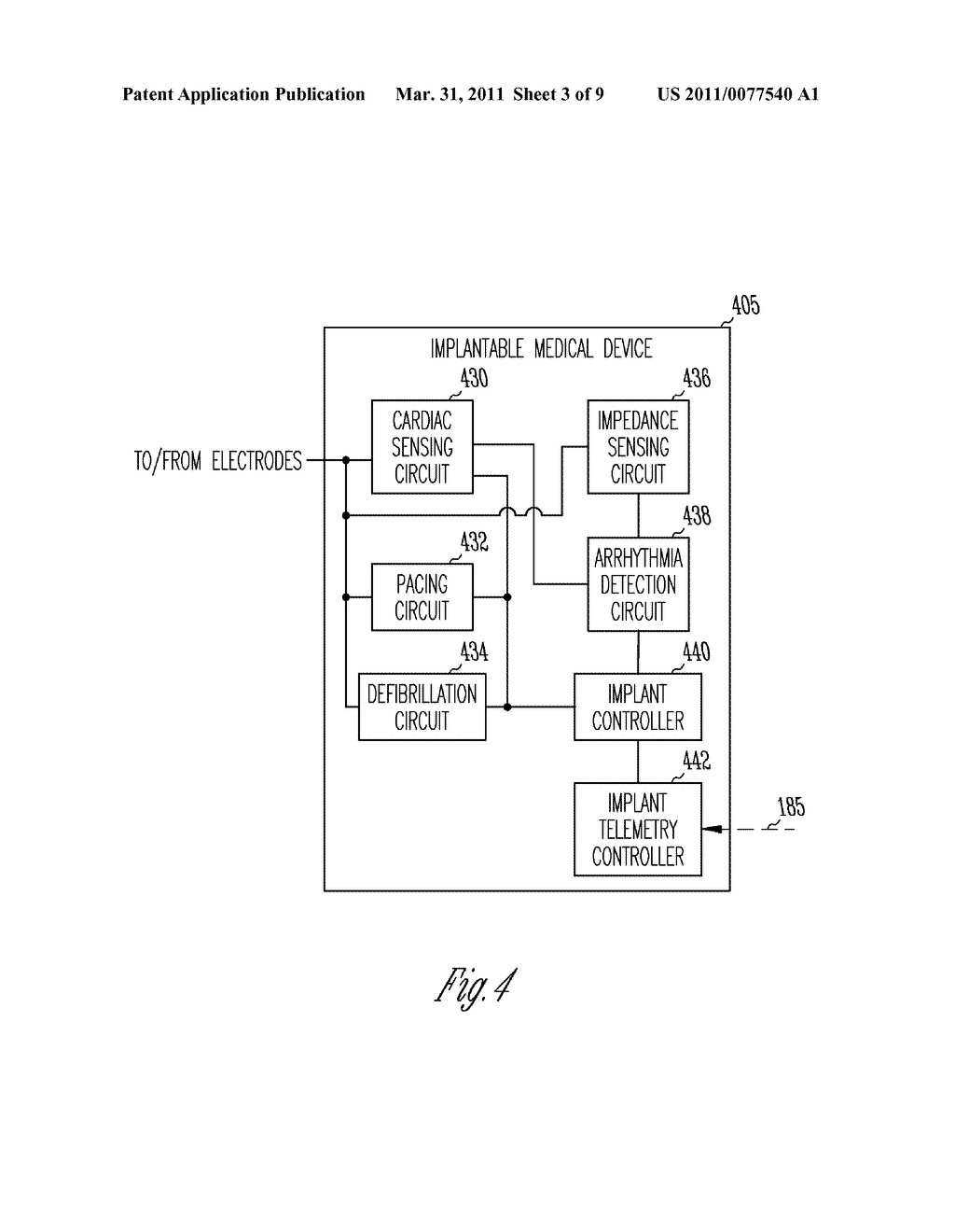 METHOD AND APPARATUS FOR DETECTING FIBRILLATION USING CARDIAC LOCAL IMPEDANCE - diagram, schematic, and image 04