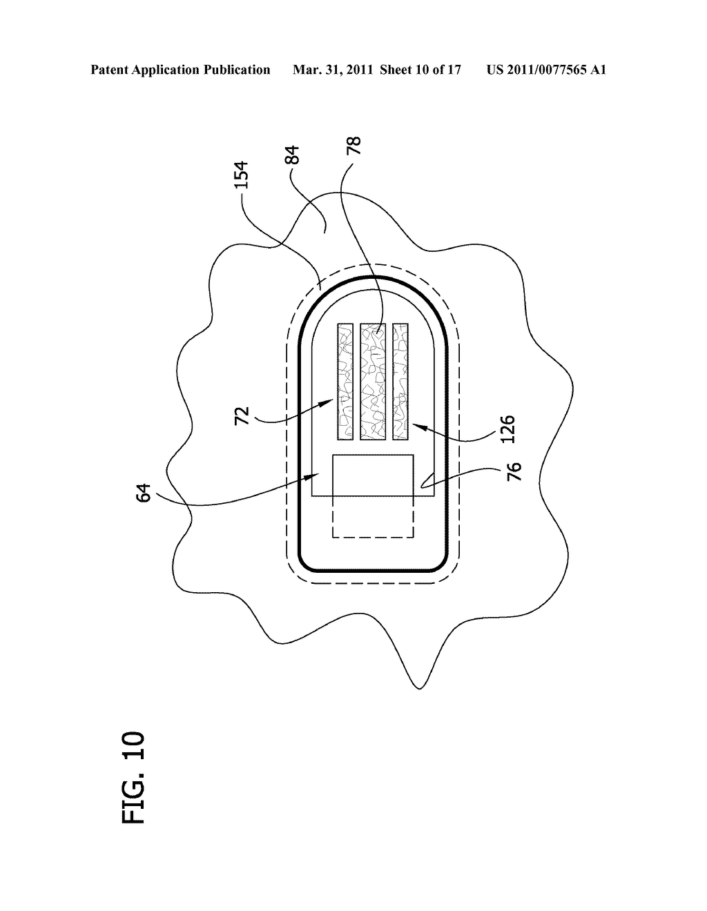 REDUCED NOISE PNEUMATIC COMPRESSION GARMENT - diagram, schematic, and image 11