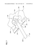 PNEUMATIC COMPRESSION GARMENT WITH NOISE ATTENUATING MEANS diagram and image