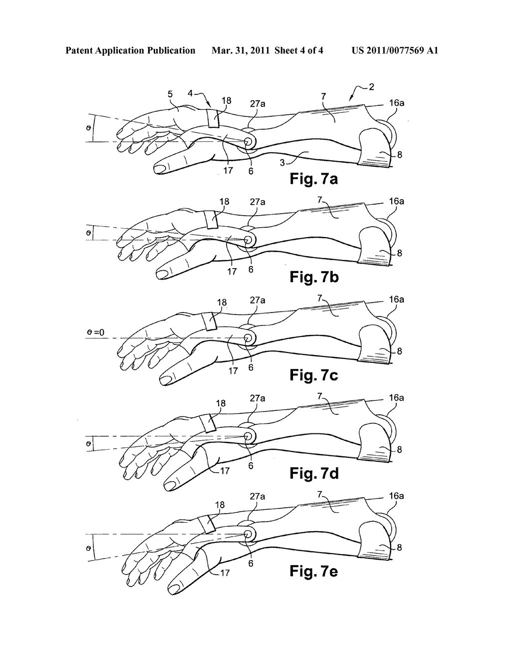 WRIST ORTHOSIS FOR TREATING CARPAL TUNNEL SYNDROME - diagram, schematic, and image 05