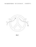 Medical Catheter Having a Design Providing Low Recirculation and Reversibility diagram and image