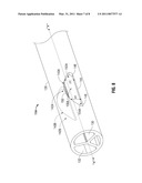 Medical Catheter Having a Design Providing Low Recirculation and Reversibility diagram and image