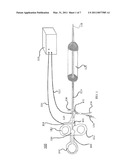 APC Dual Mode Theraputic Balloon Dilator diagram and image