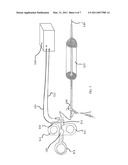 APC Dual Mode Theraputic Balloon Dilator diagram and image