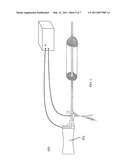 APC Dual Mode Theraputic Balloon Dilator diagram and image