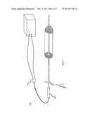 APC Dual Mode Theraputic Balloon Dilator diagram and image