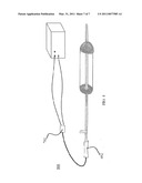 APC Dual Mode Theraputic Balloon Dilator diagram and image