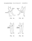 METHOD AND APPARATUS FOR MANAGING JOINT IRRIGATION DURING HIP ARTHROSCOPY diagram and image