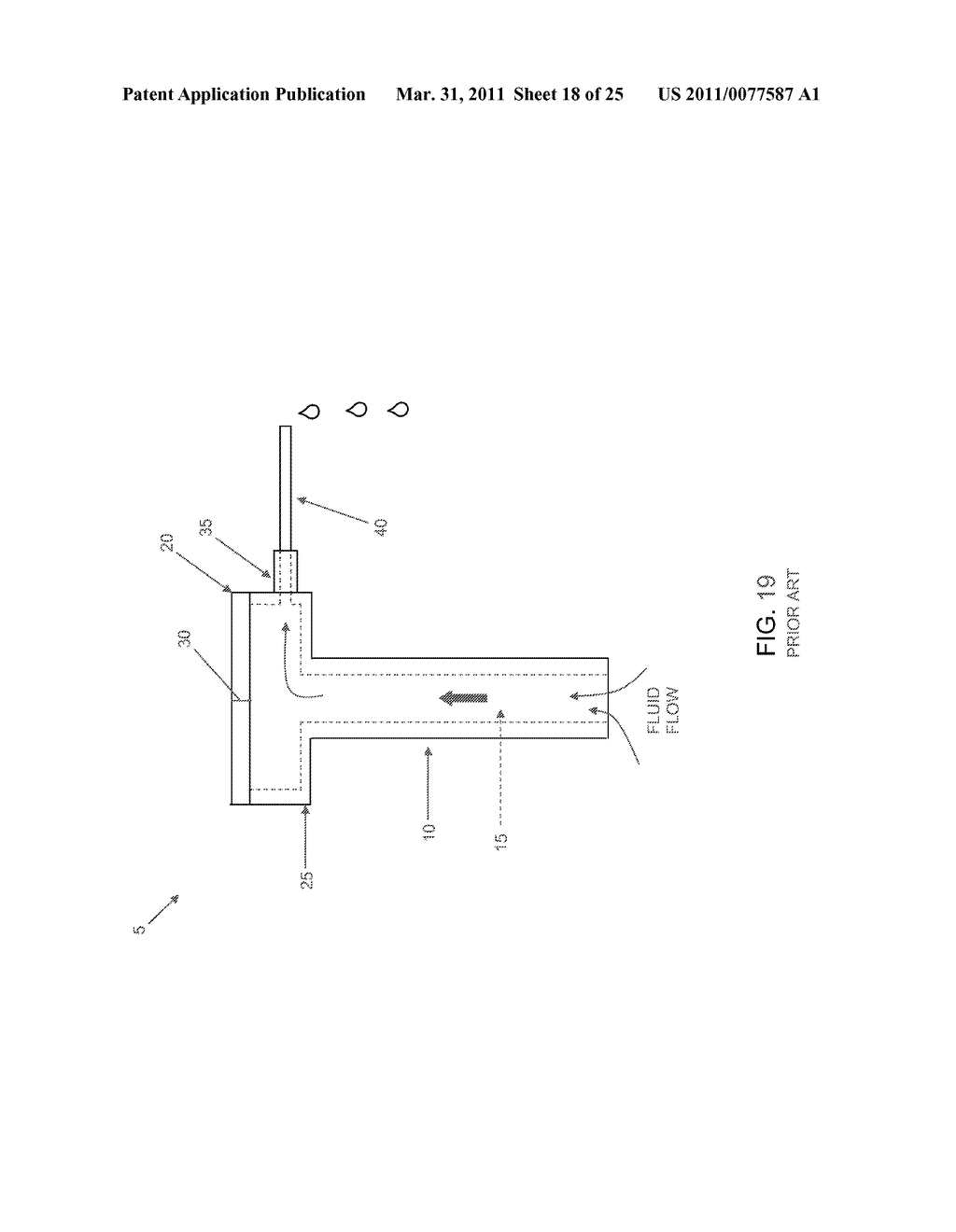 METHOD AND APPARATUS FOR MANAGING JOINT IRRIGATION DURING HIP ARTHROSCOPY - diagram, schematic, and image 19