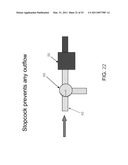 METHOD AND APPARATUS FOR MANAGING JOINT IRRIGATION DURING HIP ARTHROSCOPY diagram and image