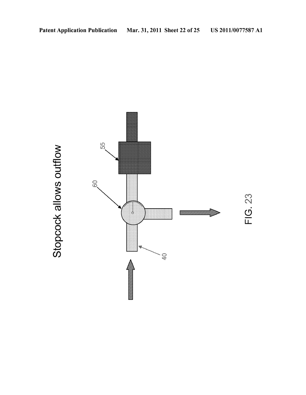 METHOD AND APPARATUS FOR MANAGING JOINT IRRIGATION DURING HIP ARTHROSCOPY - diagram, schematic, and image 23