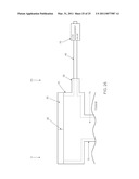 METHOD AND APPARATUS FOR MANAGING JOINT IRRIGATION DURING HIP ARTHROSCOPY diagram and image