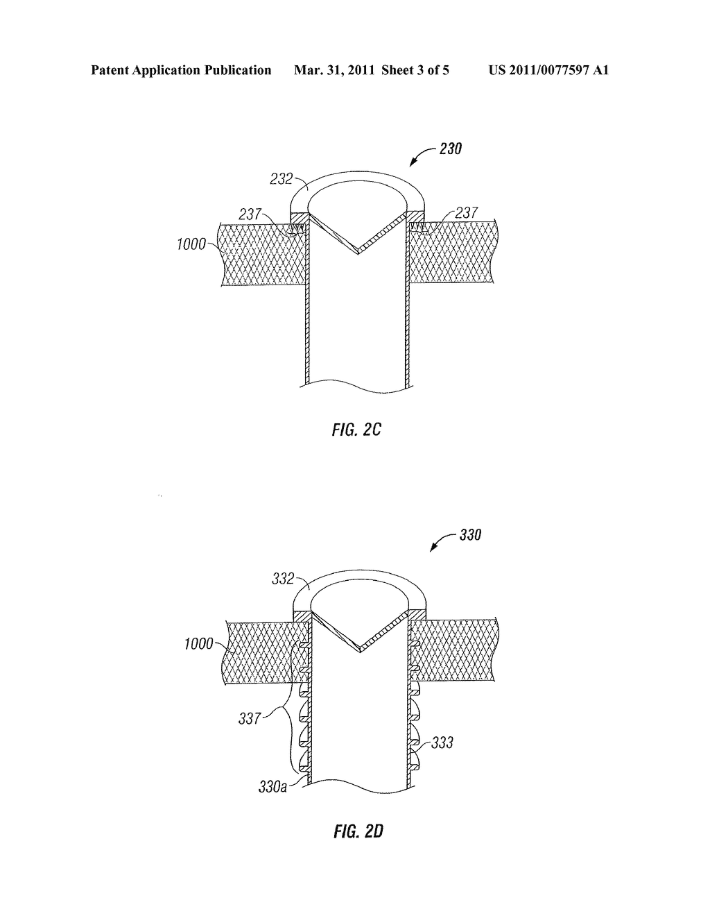 LOW PROFILE INSTRUMENT ACCESS DEVICE - diagram, schematic, and image 04