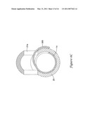 DELIVERY SYSTEM HAVING STENT LOCKING STRUCTURE diagram and image