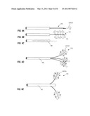 MEDICAL SYSTEM AND METHOD OF USE diagram and image