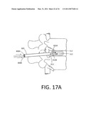 MEDICAL SYSTEM AND METHOD OF USE diagram and image