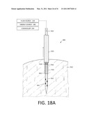 MEDICAL SYSTEM AND METHOD OF USE diagram and image