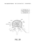 MEDICAL SYSTEM AND METHOD OF USE diagram and image