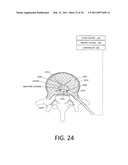 MEDICAL SYSTEM AND METHOD OF USE diagram and image