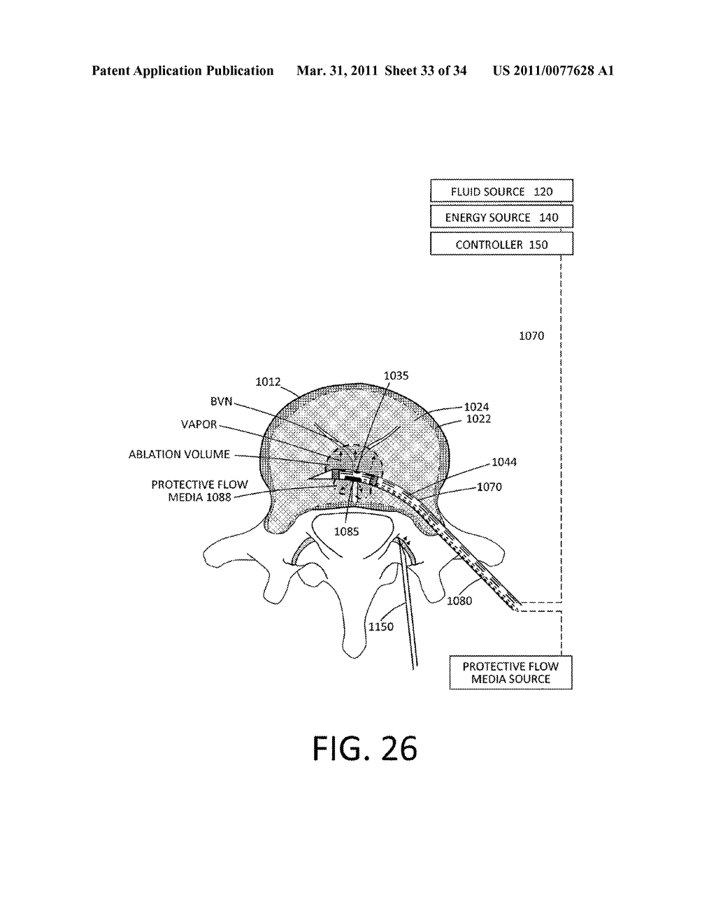 MEDICAL SYSTEM AND METHOD OF USE - diagram, schematic, and image 34