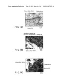 TREATMENT METHOD FOR LIVING TISSUE USING ENERGY diagram and image