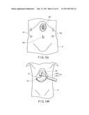 TREATMENT METHOD FOR LIVING TISSUE USING ENERGY diagram and image