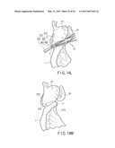 TREATMENT METHOD FOR LIVING TISSUE USING ENERGY diagram and image