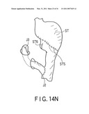 TREATMENT METHOD FOR LIVING TISSUE USING ENERGY diagram and image