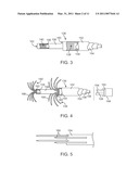 MEDICAL PROBE WITH TRANSLATABLE CO-ACCESS CANNULA diagram and image