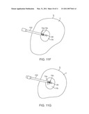 MEDICAL PROBE WITH TRANSLATABLE CO-ACCESS CANNULA diagram and image