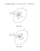 MEDICAL PROBE WITH TRANSLATABLE CO-ACCESS CANNULA diagram and image