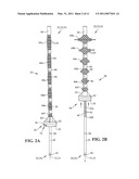 EXPANDABLE INTRAMEDULLARY ROD diagram and image