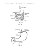 DEVICES AND METHODS FOR TREATMENT OF GASTROINTESTINAL DISORDERS diagram and image
