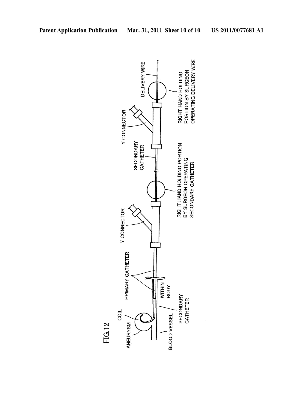 INSERTION DEVICE AND INSERTION METHOD OF COIL - diagram, schematic, and image 11