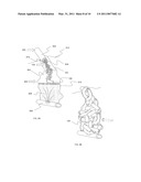 Hemorrhage Control Devices and Methods diagram and image