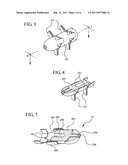 INTERSPINOUS PROCESS IMPLANT HAVING A COMPLIANT SPACER diagram and image