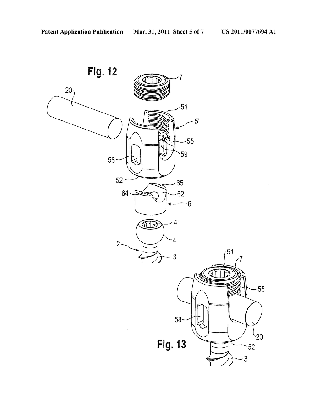 BONE ANCHORING DEVICE - diagram, schematic, and image 06