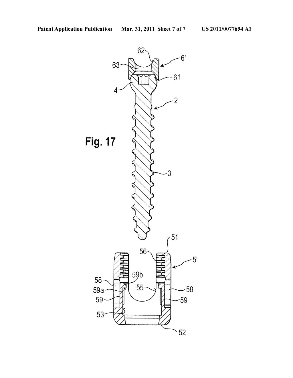 BONE ANCHORING DEVICE - diagram, schematic, and image 08