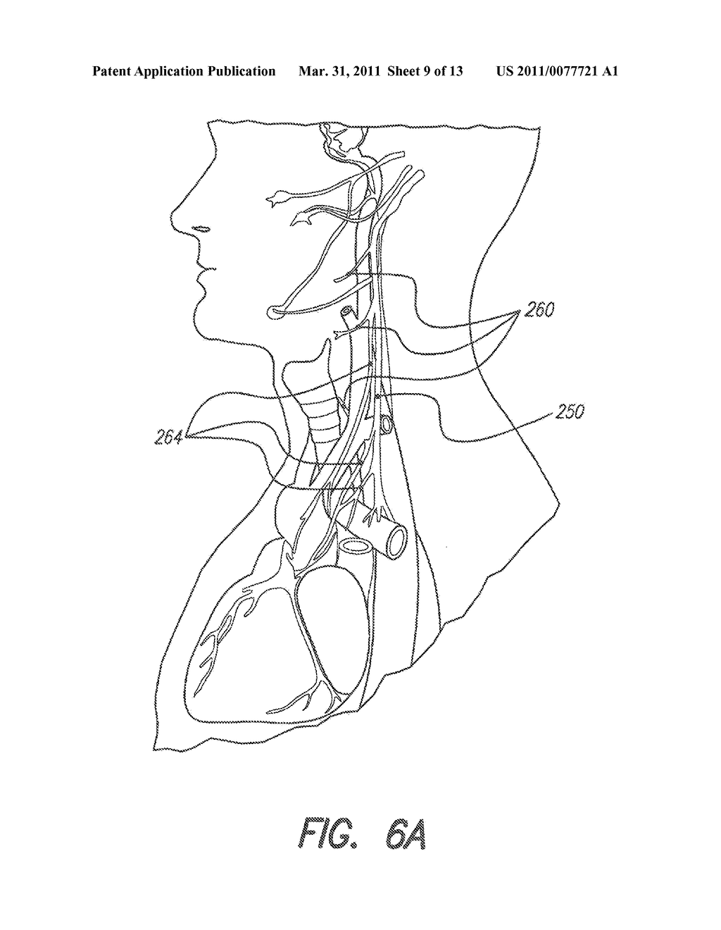 IMPLANTABLE MICROSTIMULATORS AND METHODS FOR UNIDIRECTIONAL PROPAGATION OF ACTION POTENTIALS - diagram, schematic, and image 10