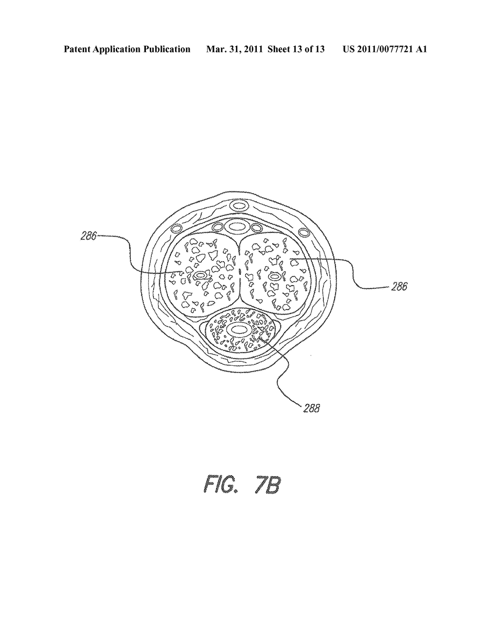 IMPLANTABLE MICROSTIMULATORS AND METHODS FOR UNIDIRECTIONAL PROPAGATION OF ACTION POTENTIALS - diagram, schematic, and image 14